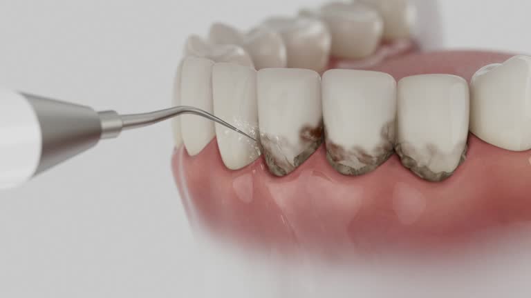 Reliable Dental Implants contractor in High Ridge, MO by Smile Center Dentistry